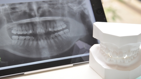 涌谷町・涌谷町、美里町、遠田郡、石巻市の顎関節症治療